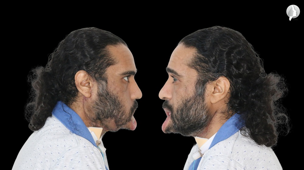 The patient 8 weeks later