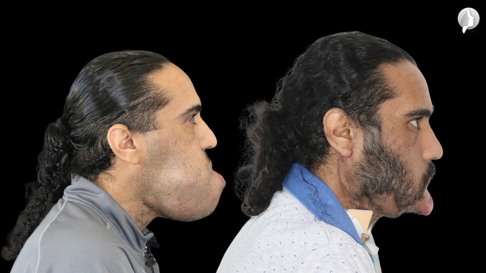 The patient before and after